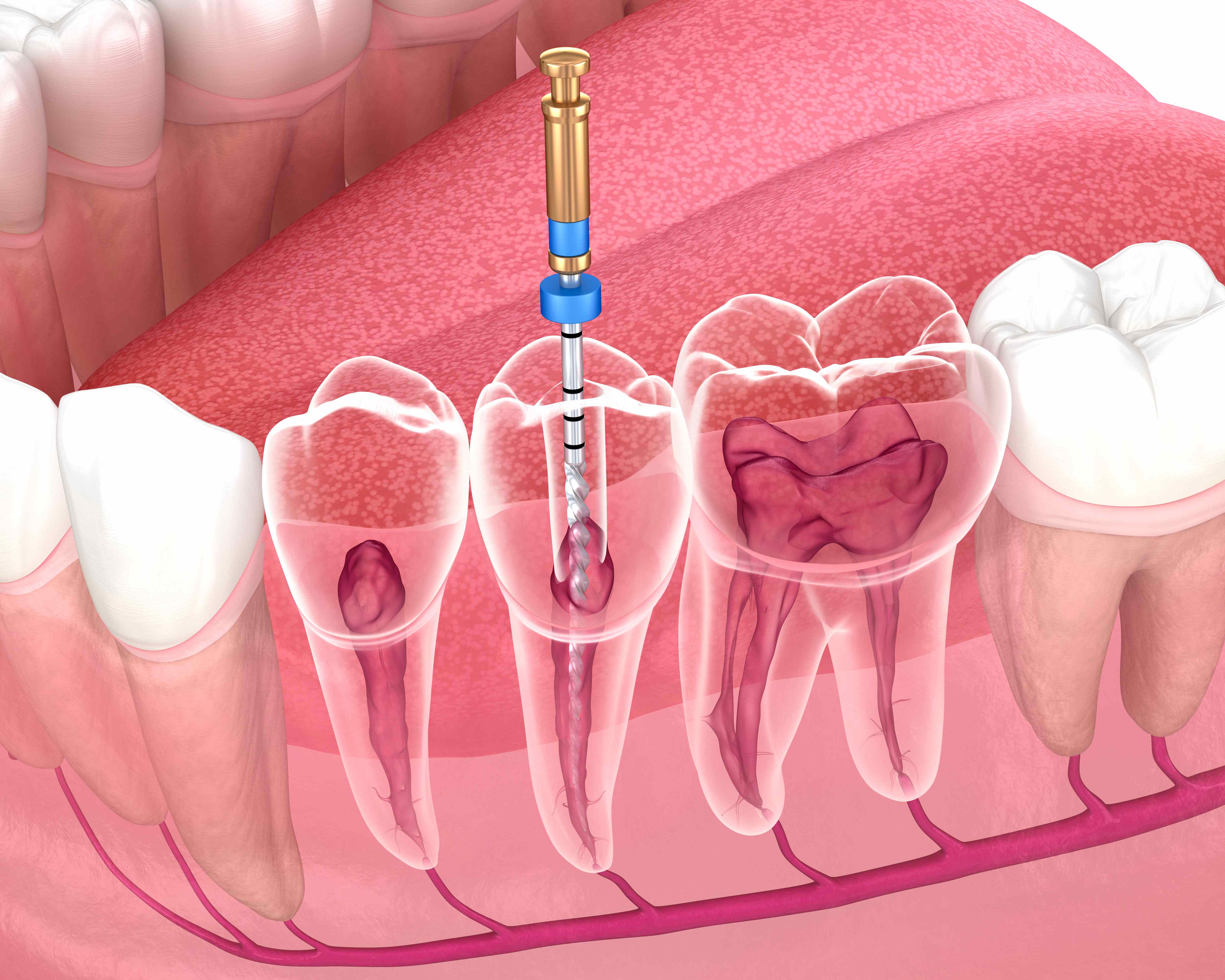 Woman sharing healthy smile after dental checkup and teeth cleaning